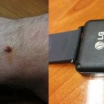 #corrosiongate : les connecteurs de la LG G Watch responsables de brûlures ? #corrosiongate : les connecteurs de la LG G Watch responsables de brûlures ?