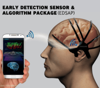 EDSAP samsung capteur cerebral avc