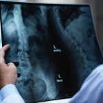 L’IA est plus fiable que les docteurs pour diagnostiquer une tumeur L’IA est plus fiable que les docteurs pour diagnostiquer une tumeur