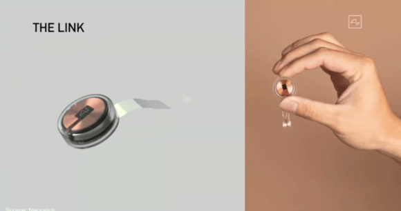 L'implant // Source : Neuralink L'implant // Source : Neuralink