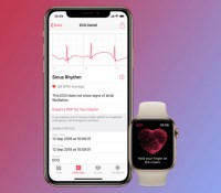 145727-smartwatches-feature-apple-ecg-watch-images-image1-4fobwxzl53