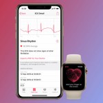 watchOS 7.5 disponible : les nouveautés sur votre Apple Watch watchOS 7.5 disponible : les nouveautés sur votre Apple Watch