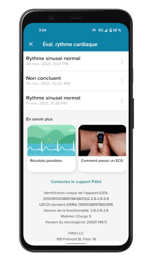 Fitbit Charge 5 - ECG App (2)