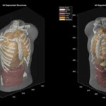 Midjourney, le générateur d’images, promet un scan « comparable à l’IRM » via ultrasons et IA Midjourney, le générateur d’images, promet un scan « comparable à l’IRM » via ultrasons et IA
