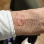 Plusieurs modèles de Galaxy Watch accusés de brûler le poignet de leurs utilisateurs pendant la nuit