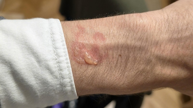 Plusieurs modèles de Galaxy Watch accusés de brûler le poignet de leurs utilisateurs pendant la nuit